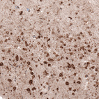Anti-HSP90B1 Antibody