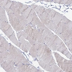 Immunohistochemical staining of human skeletal muscle shows no positivity in myocytes.
