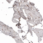 Immunohistochemical staining of human skeletal muscle shows very weak cytoplasmic positivity in myocytes.
