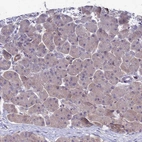 Immunohistochemical staining of human pancreas shows no positivity in exocrine glandular cells as expected.