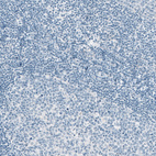 Immunohistochemical staining of human tonsil shows no positivity in lymphoid cells as expected.