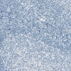 Immunohistochemical staining of human tonsil shows no positivity in lymphoid cells as expected.