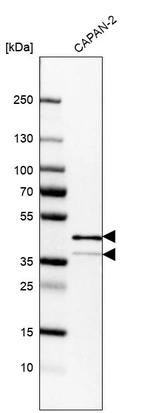 Western blot analysis in human cell line CAPAN-2.