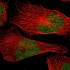Immunofluorescent staining of human cell line U-2 OS shows localization to nucleus.