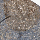 Immunohistochemical staining of human tonsil shows strong cytoplasmic positivity in germinal center cells.