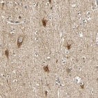 Immunohistochemical staining of human cerebral cortex shows strong cytoplasmic positivity in neurons.