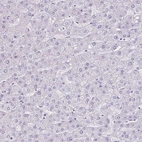 Immunohistochemical staining of human liver shows no positivity in hepatocytes as expected.