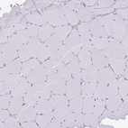 Immunohistochemical staining of human skeletal muscle shows no positivity in myocytes as expected.