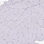 Immunohistochemical staining of human skeletal muscle shows no positivity in myocytes as expected.