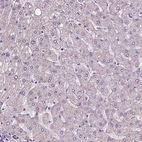 Immunohistochemical staining of human liver shows no positivity in hepatocytes as expected.