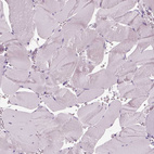 Immunohistochemical staining of human skeletal muscle shows no positivity in myocytes as expected.