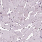 Immunohistochemical staining of human skeletal muscle shows no positivity in myocytes as expected.