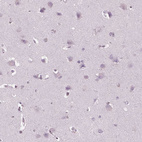 Immunohistochemical staining of human cerebral cortex shows no positivity in neurons as expected.