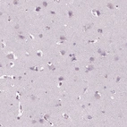 Immunohistochemical staining of human cerebral cortex shows no positivity in neurons as expected.