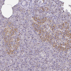 Immunohistochemical staining of human pancreas shows strong cytoplasmic granular positivity in islets of Langerhans.