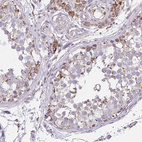Immunohistochemical staining of human testis shows strong cytoplasmic granular positivity in seminiferous ducts.