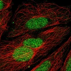 Immunofluorescent staining of human cell line SiHa shows localization to nucleus.