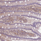 Immunohistochemical staining of human duodenum shows moderate cytoplasmic positivity in lymphoid cells.