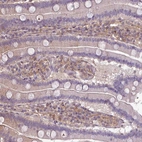 Immunohistochemical staining of human duodenum shows moderate cytoplasmic positivity in lymphoid cells.