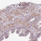Immunohistochemical staining of human prostate shows moderate cytoplasmic positivity in smooth muscle cells.