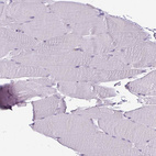 Immunohistochemical staining of human skeletal muscle shows no positivity in myocytes as expected.