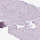 Immunohistochemical staining of human skeletal muscle shows no positivity in myocytes as expected.