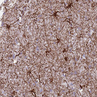 Immunohistochemical staining of human cerebral cortex shows strong membranous positivity in astrocytes.