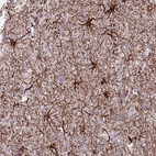 Immunohistochemical staining of human cerebral cortex shows strong membranous positivity in astrocytes.