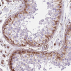 Immunohistochemical staining of human testis shows strong membranous positivity in spermatogonia.