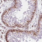 Immunohistochemical staining of human testis shows strong membranous positivity in spermatogonia.