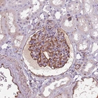 Immunohistochemical staining of human kidney shows strong membranous positivity in cells in glomeruli.