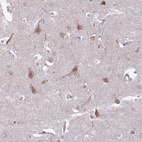 Immunohistochemical staining of human cerebral cortex shows moderate cytoplasmic positivity in neurons.