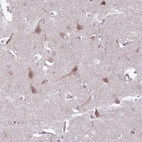 Immunohistochemical staining of human cerebral cortex shows moderate cytoplasmic positivity in neurons.