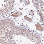 Immunohistochemical staining of human testis shows moderate cytoplasmic positivity in Leydig cells.