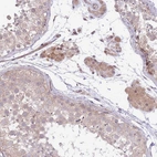 Immunohistochemical staining of human testis shows moderate cytoplasmic positivity in Leydig cells.