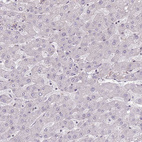 Immunohistochemical staining of human liver shows no positivity in hepatocytes as expected.