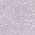 Immunohistochemical staining of human liver shows no positivity in hepatocytes as expected.