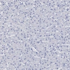 Immunohistochemical staining of human liver shows no positivity in hepatocytes.