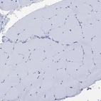 Immunohistochemical staining of human skeletal muscle shows no positivity in myocytes.