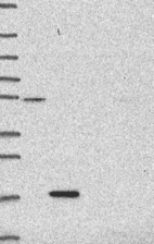 Lane 1: Marker [kDa] 250, 130, 95, 72, 55, 36, 28, 17, 10 | Lane 2: RT4 | Lane 3: U-251 MG | Lane 4: Human Plasma | Lane 5: Liver | Lane 6: Tonsil