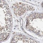 Immunohistochemical staining of human testis shows moderate cytoplasmic positivity in cells in seminiferous ducts and Leydig cells.