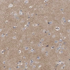 Immunohistochemical staining of human cerebral cortex shows moderate cytoplasmic positivity in neuropil.