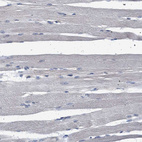 Immunohistochemical staining of human skeletal muscle shows no positivity in myocytes as expected.