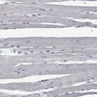 Immunohistochemical staining of human skeletal muscle shows no positivity in myocytes as expected.