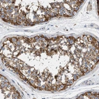 Immunohistochemical staining of human testis shows strong cytoplasmic positivity in cells in seminiferous ducts.
