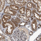 Immunohistochemical staining of human kidney shows strong cytoplasmic positivity in cells in tubules.