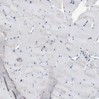 Immunohistochemical staining of human skeletal muscle shows no positivity in myocytes as expected.