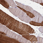 Immunohistochemical staining of human skeletal muscle shows strong cytoplasmic positivity in myocytes.