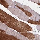 Immunohistochemical staining of human skeletal muscle shows strong cytoplasmic positivity in myocytes.