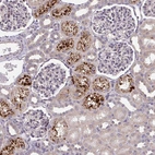 Immunohistochemical staining of human kidney shows strong granular cytoplasmic positivity in cells in tubules.